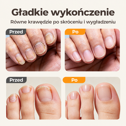 Efekt przed i po skróceniu oraz wygładzeniu paznokci